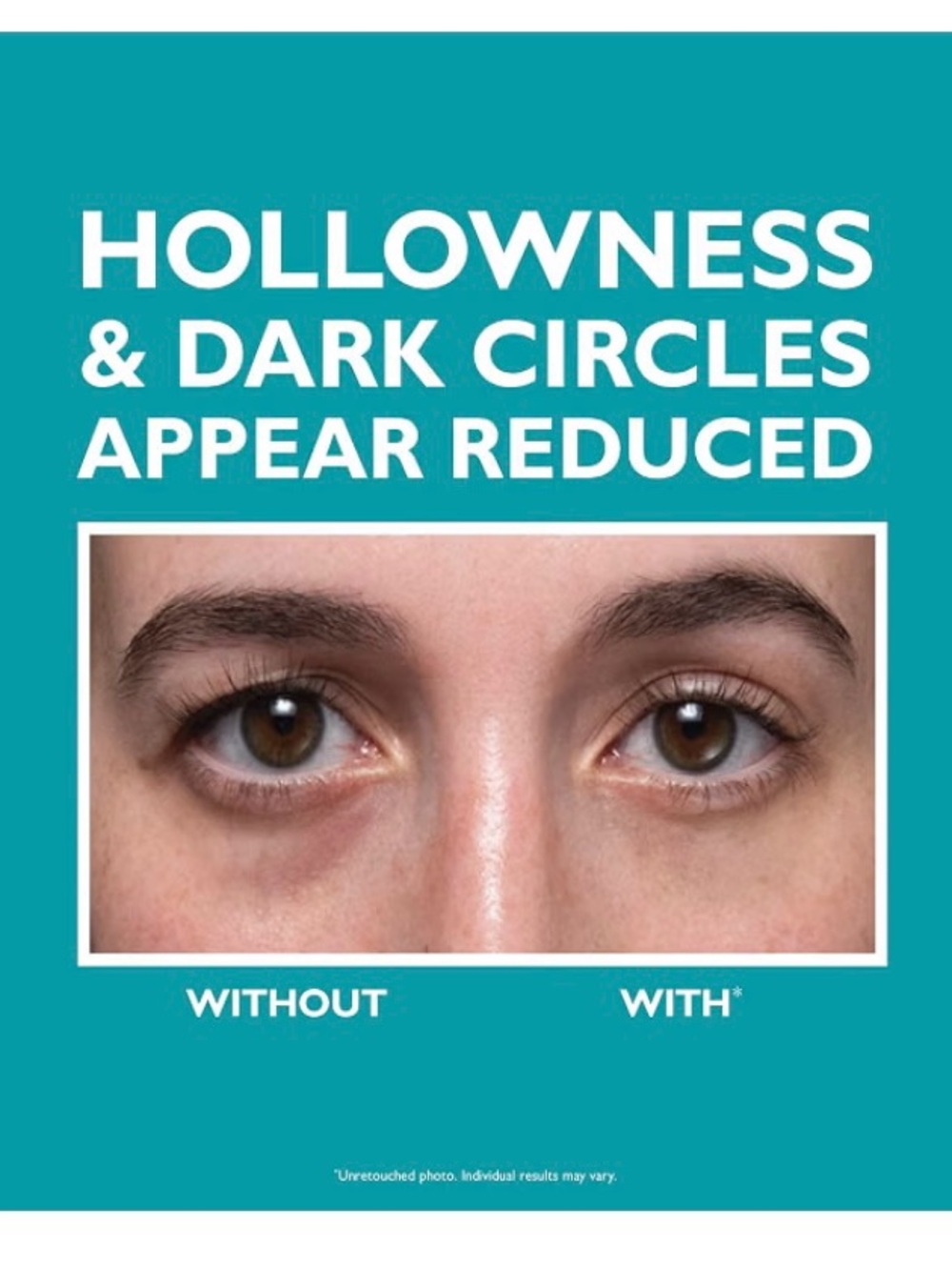 Peter Thomas Roth Peptide Skin Injection Fill + Fix Under-Eye Cream - - Picture 5 of 8